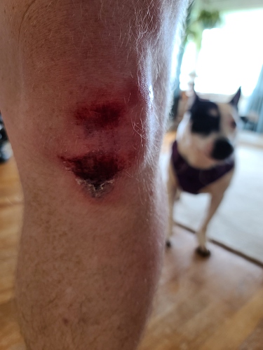 knee