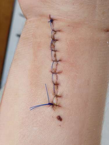 IMG_20190702_111022_1